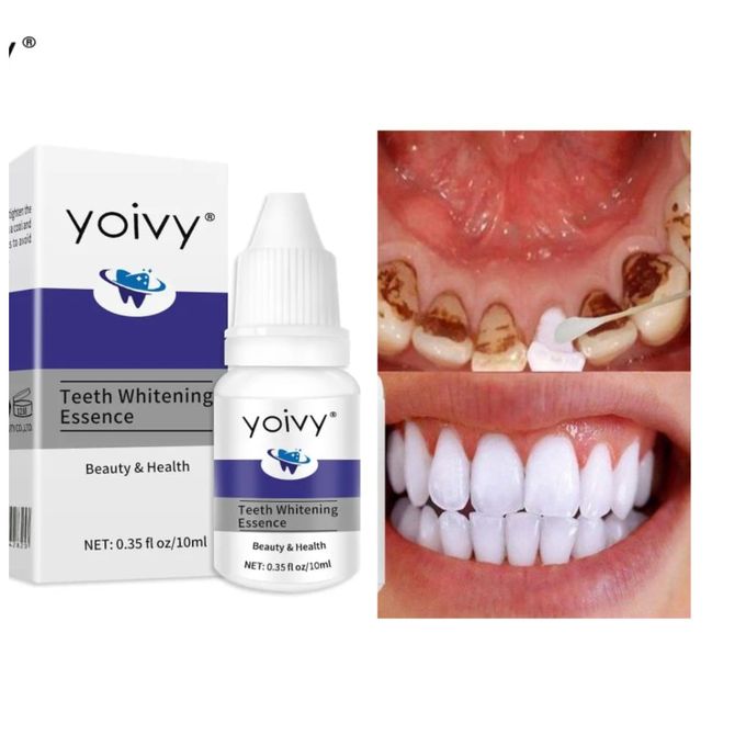 Teeth Whitening Liquid, Yoivy Teeth Whitener, Brown Teeth Whitening Essence
