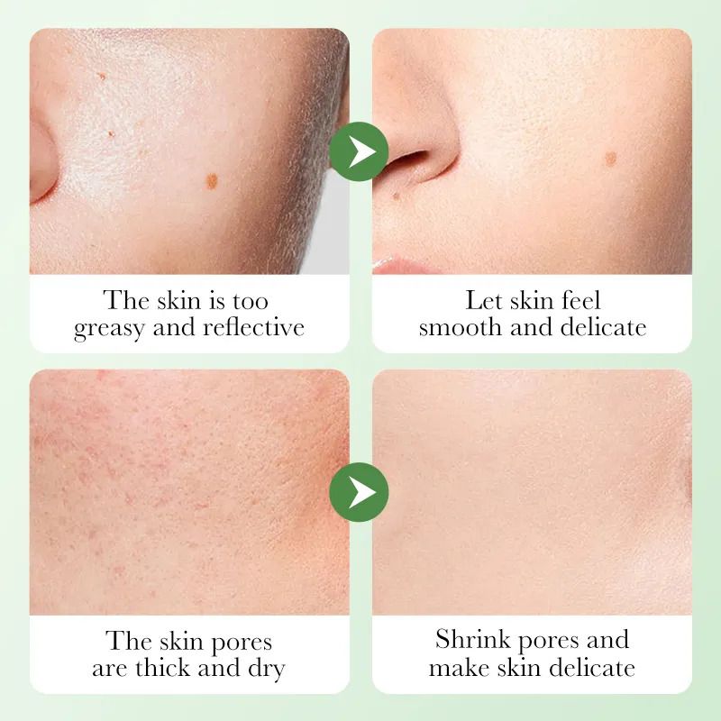 Sadoer Centella Asiatica Soothing Repair Serum, Oil Control, Anti Acne, Soothing Repair and Nourish, Can add Vitamin C, Fades Skin Sensitivity Redness, Makes Skin Tender and Smooth
