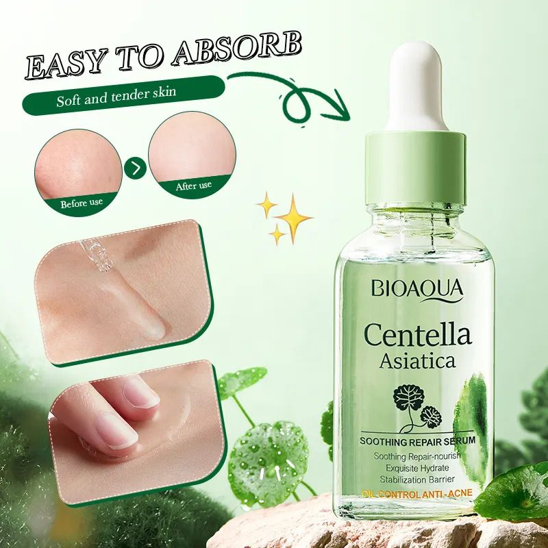 Sadoer Centella Asiatica Soothing Repair Serum, Oil Control, Anti Acne, Soothing Repair and Nourish, Can add Vitamin C, Fades Skin Sensitivity Redness, Makes Skin Tender and Smooth