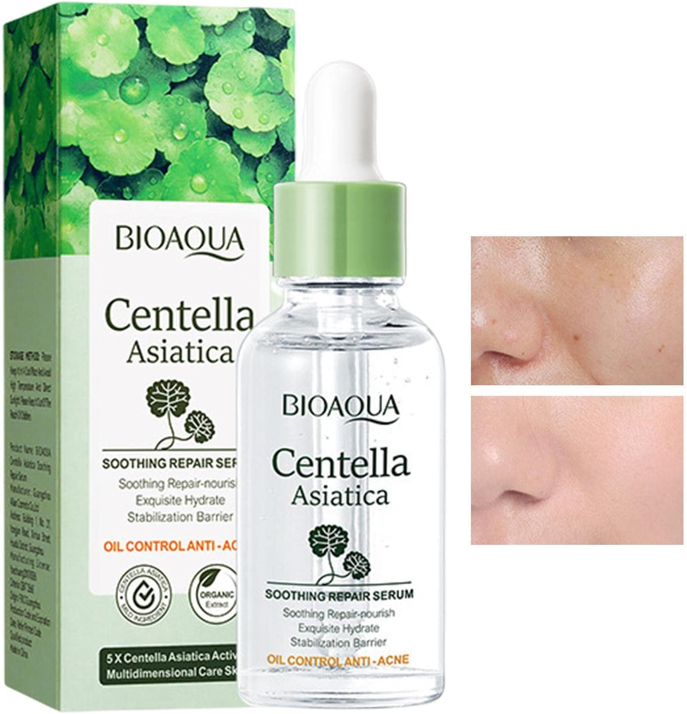 Sadoer Centella Asiatica Soothing Repair Serum, Oil Control, Anti Acne, Soothing Repair and Nourish, Can add Vitamin C, Fades Skin Sensitivity Redness, Makes Skin Tender and Smooth