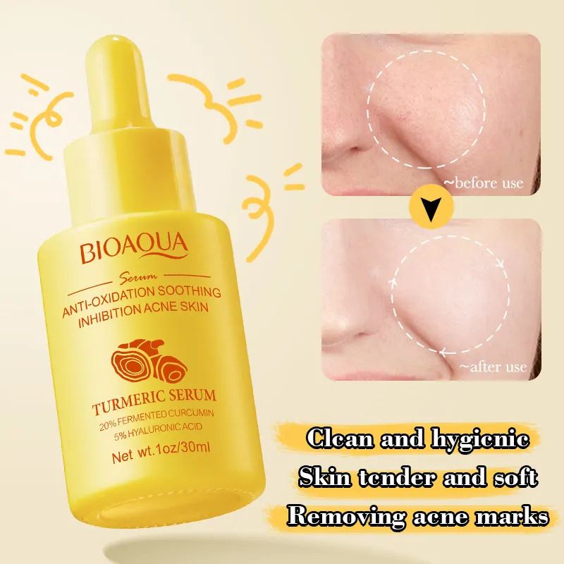 5 in 1 Sadoer Turmeric Set, Tumeric Cleanser + Face Serum +Face Toner + Face Cream + Collagen Soap, with unparelled Vitamin C capabilities, Helps in Preven Acne, Sooth, Hydrate, Lighjten Acne Marks