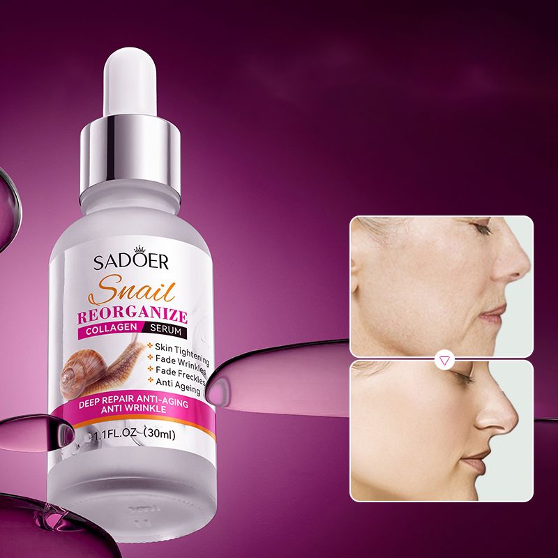 5 in 1 Set, Sadoer Vitamin C Serum + Sadoer Collagen Snail Serum + Nicotinamide Serum + Hyaluronic Acid Serum +Retinol Serum, Moisturizing, Anti Wrinkles, Anti Aging, Skin Tightening, Whiten Dark Spo