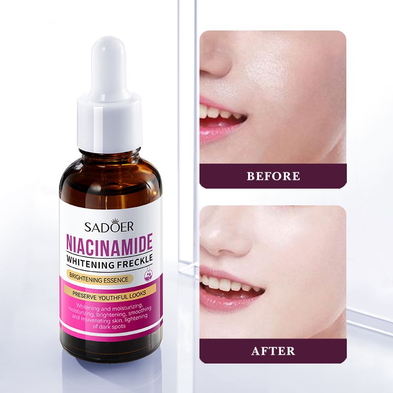 SADOER Niacinamide Serum, Nicotinamide  Dispels Freckles and Whitens Dark Spots, Repair Skin Barrier, Fade Hyperpigmentation, Like Vitamin C, Enhances Skin Glow, Nourish