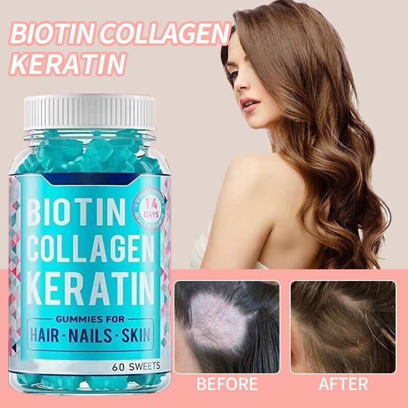 Biotin Collagen Keratin Gummies - Hair,Skin and Nails  Vitamin A Vitamin C Vitamin E Sodium Zinc Food Supplement 60 Gummies - Biotin Collagen Keratin Gummies,- Restore the beauty of hair skin and hair