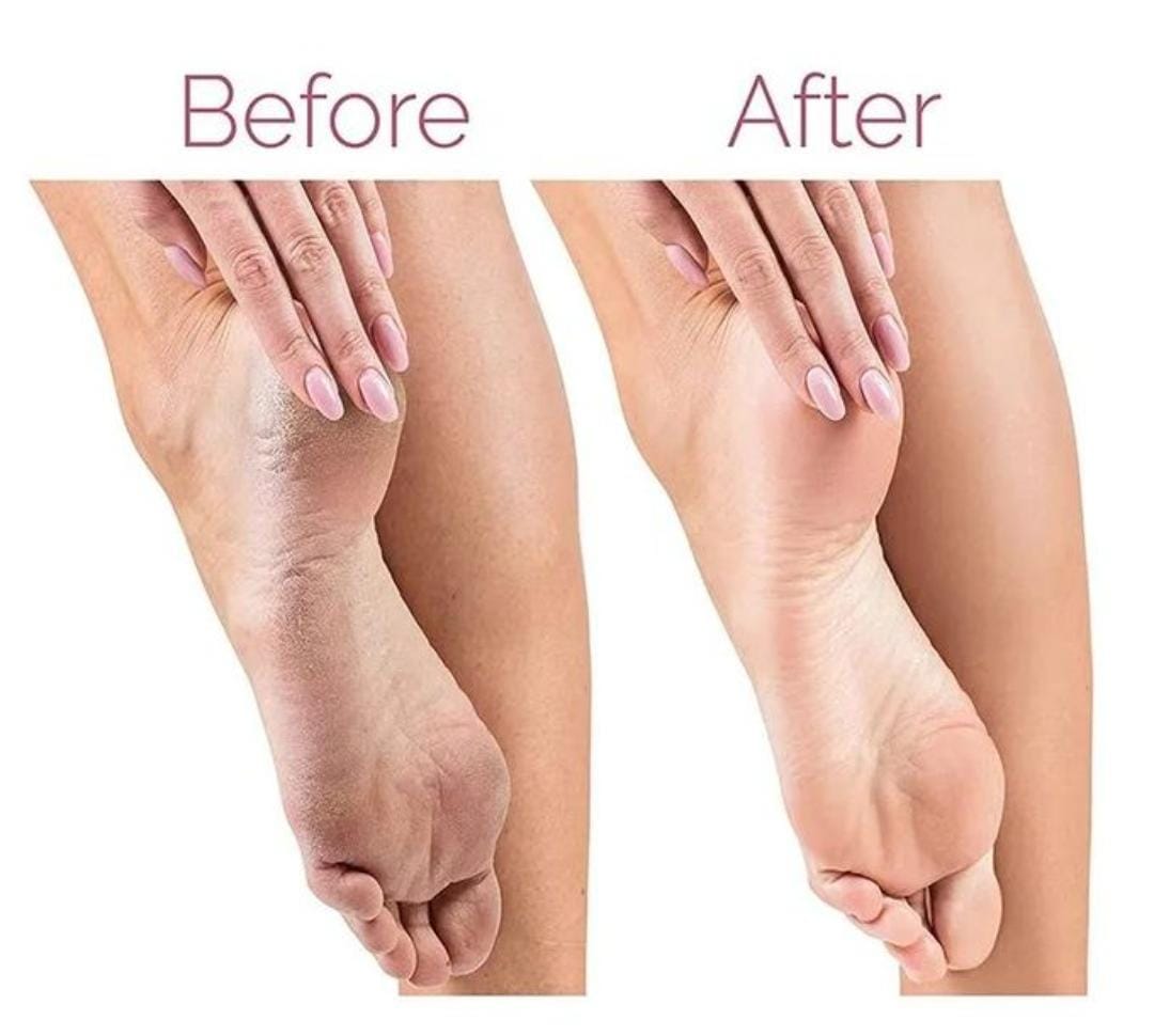 Rechargeable Electric Foot Callus Remover Pedicure Machine