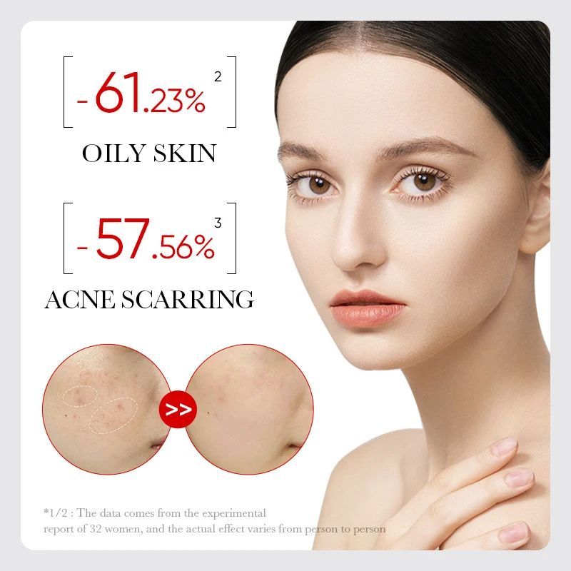 Sadoer AHA BHA Fruit Acid Serum - Acne Repair, Pore Minimizer & Exfoliating Face Serum for Clear, Smooth Skin ideal for oily, combination, and acne-prone skin