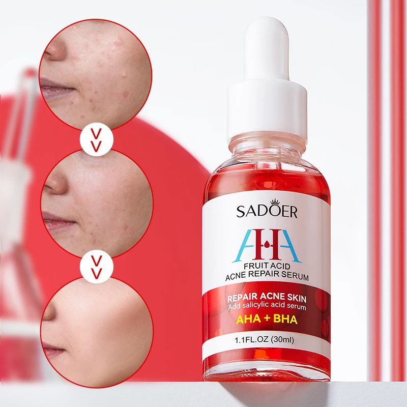 Sadoer AHA BHA Fruit Acid Serum - Acne Repair, Pore Minimizer & Exfoliating Face Serum for Clear, Smooth Skin ideal for oily, combination, and acne-prone skin