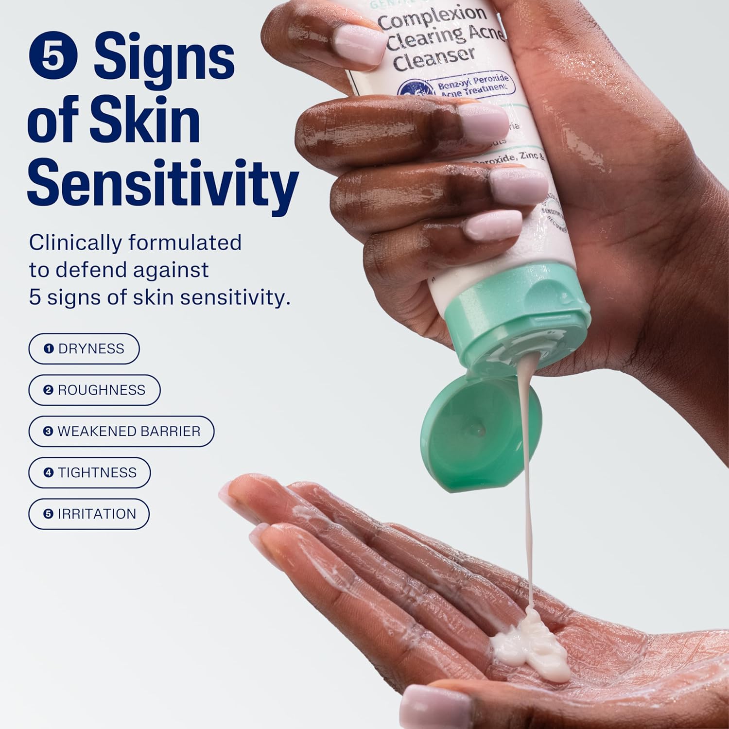 Cetaphil Acne Gentle Clear Cleanser 124ml | 2.6% Benzoyl Peroxide Acne Treatment, Clears Breakouts Fast, Targets Acne-Causing Bacteria, Zinc & Licorice Root for Sensitive Skin