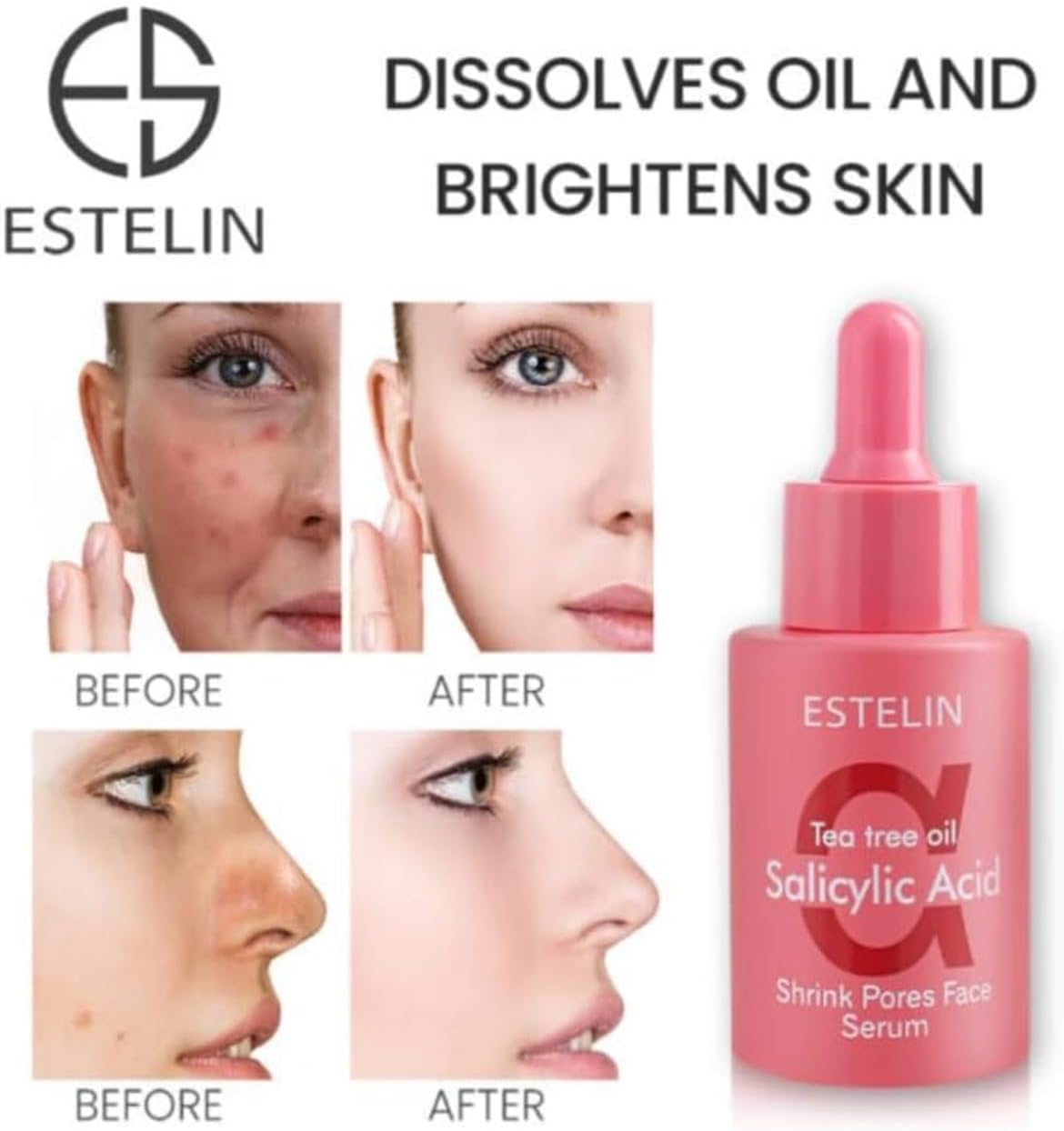 Estelin Tea Tree Oil Salicylic Acid Face Serum 30ml Anti Acne Pore Minimizing Serum Oil Control Hydrating Skin Repair Brightening Shrink Pores Facial Essence For Oily Acne Prone Skin Daily Skincare