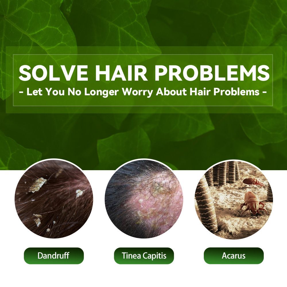 Dandruff Remover Shampoo Therapeutic Shampoo Treatment for Itching Flaking Scalp Psoriasis Seborrheic Dermatitis Hair Care 100ml