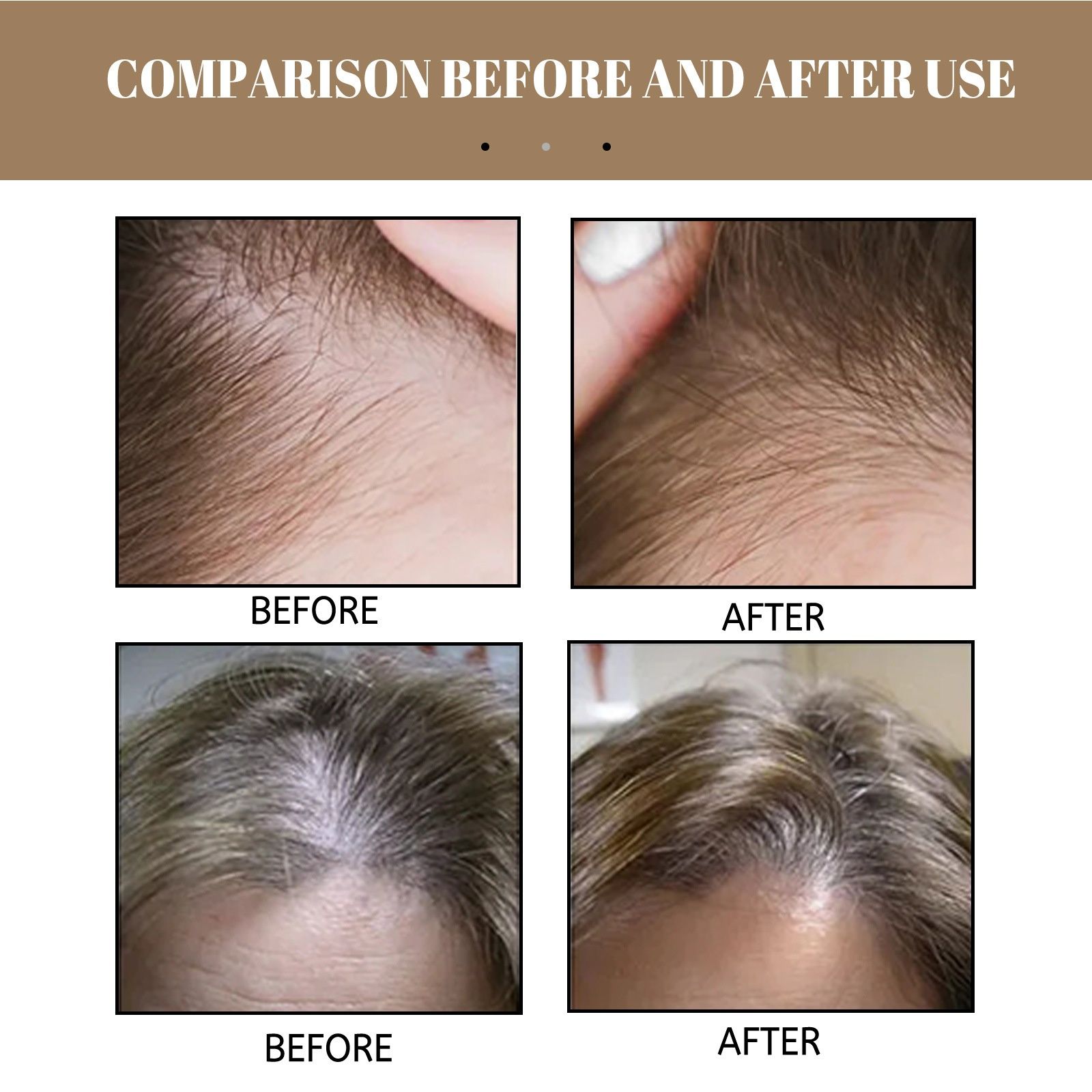 EELHOE Rice Anti Hair Loss Shampoo for Hair Firming, Hair Strengthening, Cleaning, Nourishing, Rooting, Nourishing, Hair Care