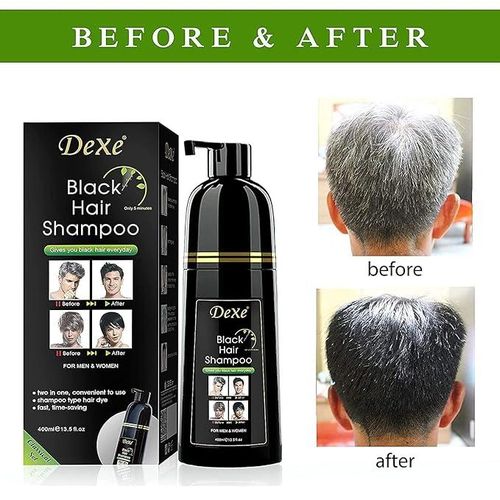 Dexe Black Shampoo Hair Dye- 400ml- Instant Black Hair Color for Men Women/ Black Hair Color/ Simple to Use/ Long Lasting- Fast Acting/ Natural Ingredients- No Hair Damage, Infused Natual Ingredients