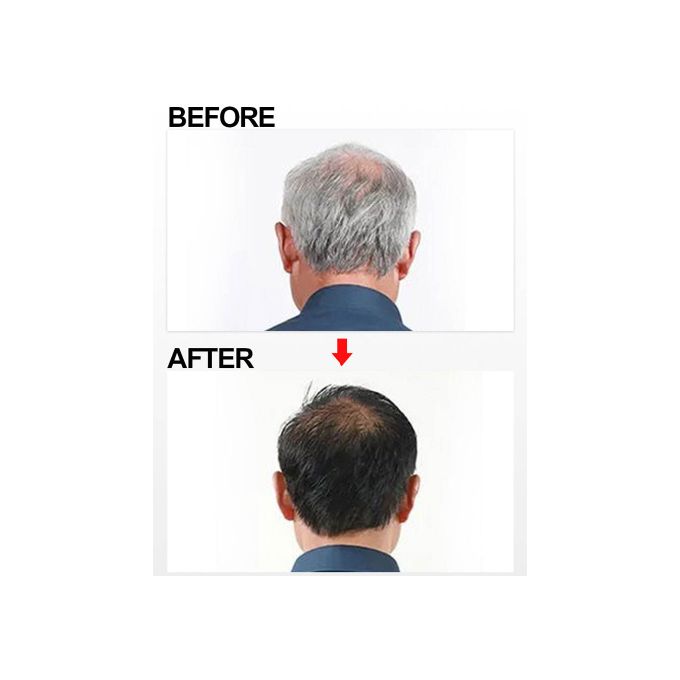 Dexe Black Shampoo Hair Dye- 400ml- Instant Black Hair Color for Men Women/ Black Hair Color/ Simple to Use/ Long Lasting- Fast Acting/ Natural Ingredients- No Hair Damage, Infused Natual Ingredients
