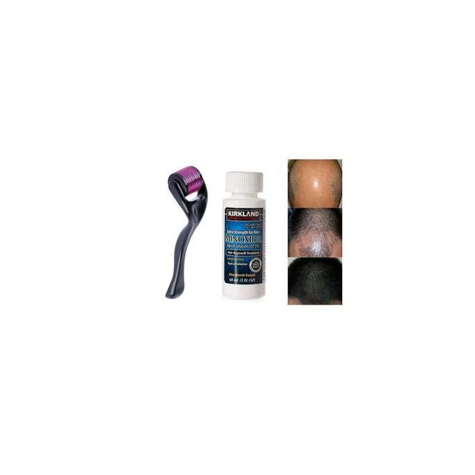 Kirkland Minoxidil 5% Hair Regrowth + Free Derma Roller Treatment – Beard & Hair Growth Solution (1 Month Supply) + Dermaroller
