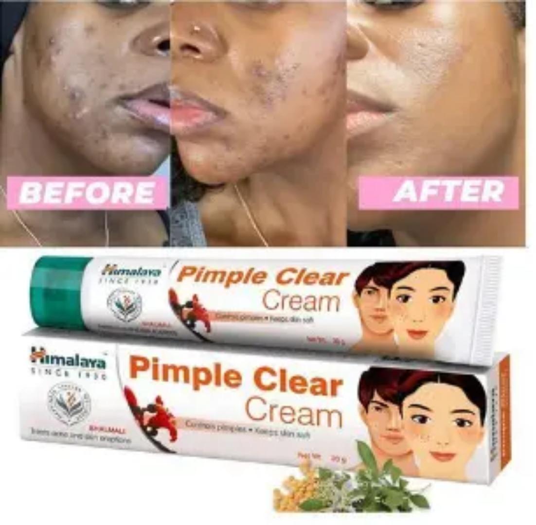 Himalaya Herbals Acne-n-Pimple Cream