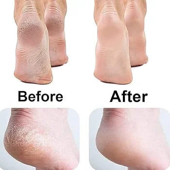 PEDI CALLUS REMOVER WITH EXTRA GRINDER TOOL..FINISHING TOUCH FLAWLESS PEDI ELECTRONIC TOOL FILE AND CALLUS REMOVER, PEDICURE