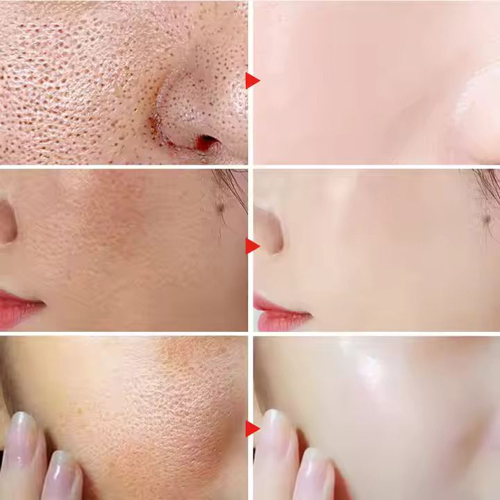 MOOYAM 5-in-1 Facial Serum – Advanced Anti-Aging Skincare with Hyaluronic Acid, Vitamin C, Niacinamide & Collagen – Brightens Skin Tone, Reduces Wrinkles & Hydrates Deeply – 30ml Bottle for All Skin