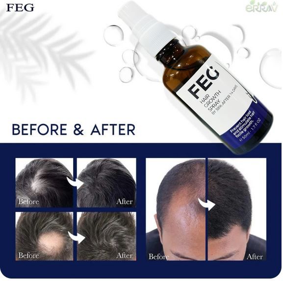 Feg Hair Growth Spray - 50ml                                                                                                                                                                   .