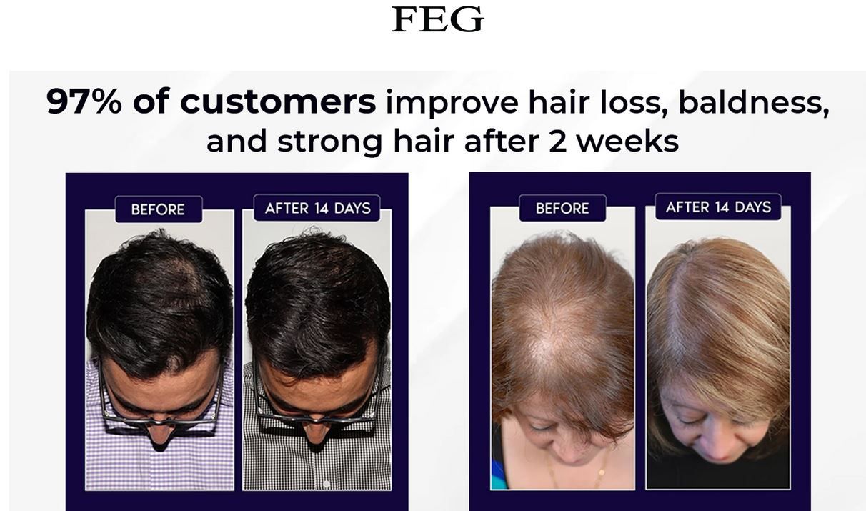 Feg Hair Growth Spray - 50ml                                                                                                                                                                   .