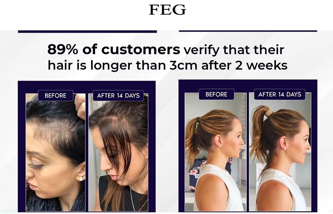 Feg Hair Growth Spray - 50ml                                                                                                                                                                   .