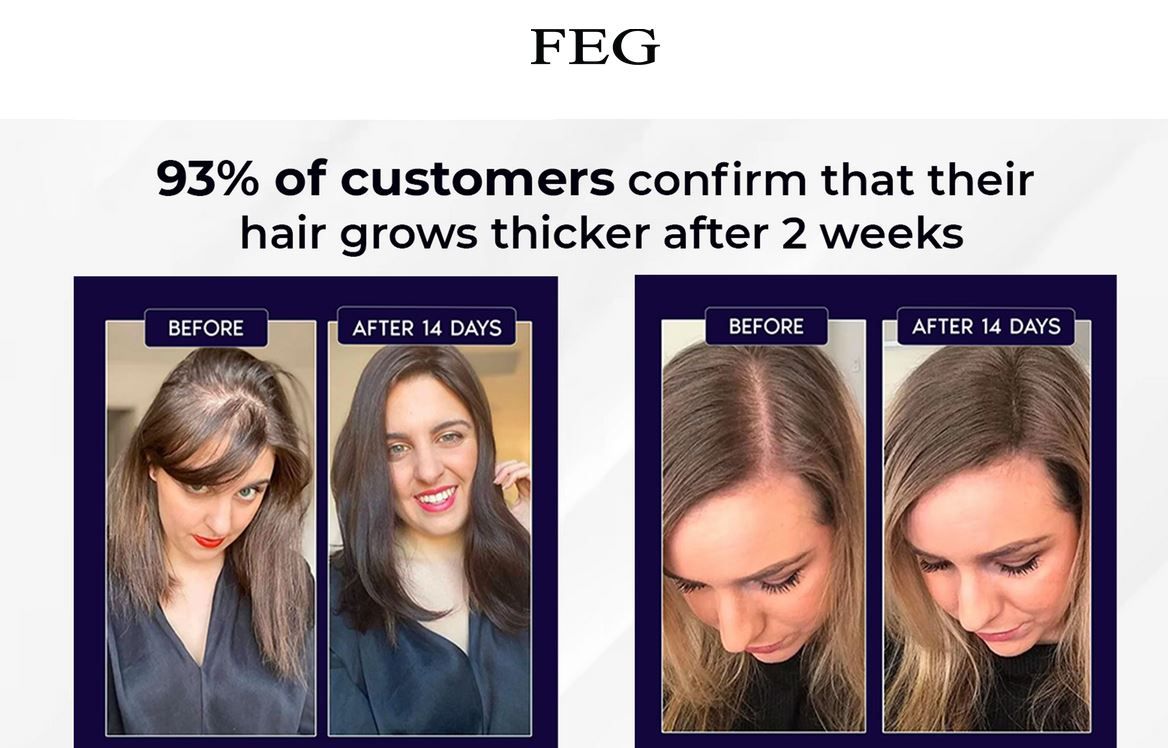 Feg Hair Growth Spray - 50ml                                                                                                                                                                   .