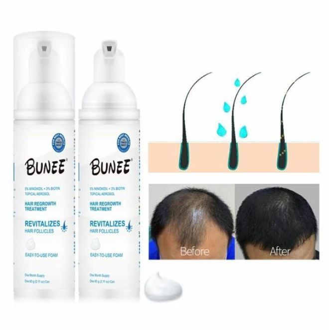 BUNEE Signature 5% Minoxidil Hair +Niacinamide + Biotin Growth Treatment, Can Foam Aerosol
 BUNEE Hair Regrowth Foam (5% Minoxidil + Biotin +Niacinamide)