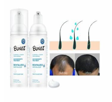 BUNEE Signature 5% Minoxidil Hair +Niacinamide + Biotin Growth Treatment, Can Foam Aerosol
 BUNEE Hair Regrowth Foam (5% Minoxidil + Biotin +Niacinamide)