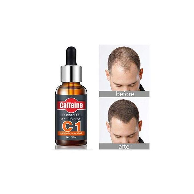 Caffeine Natural Hair Restoration Serum, Scalp Oil- Growth Essential Oil