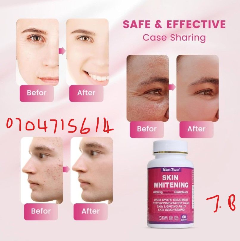 Skin Whitening by Winstown 60 Pills.8000MG GLUTATHIONE – Packed with Glutathione, one of the most powerful antioxidants, helps maintain young looking and smooth wrinkle free skin