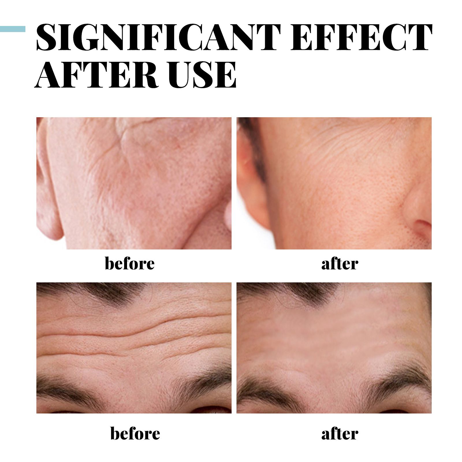 Collagen Cream for Eliminate Wrinkles,Face Moisturizer Cream,Anti-wrinkle Cream,Reduce Fine Lines and Dryness,Day & Night Skin Care Skin Tightening Cream，Suitable for Both Men and Women