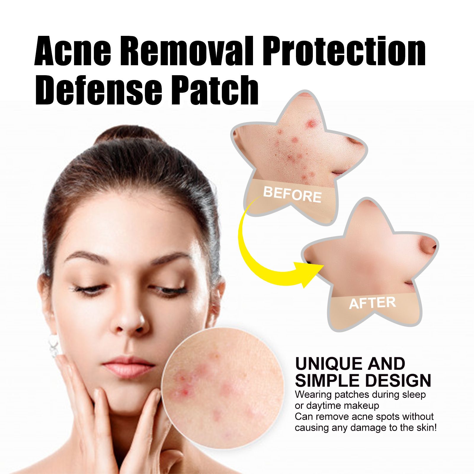 72pcs Acne Patch Acne Skin Care Product Acne Remover Acne Skin Care Acne Treatment Acne Removal Acne Control Cleanser Acne Cleanser Repair Acne Facial Skin Care Remove Acne Patch Remove Skin Acne
