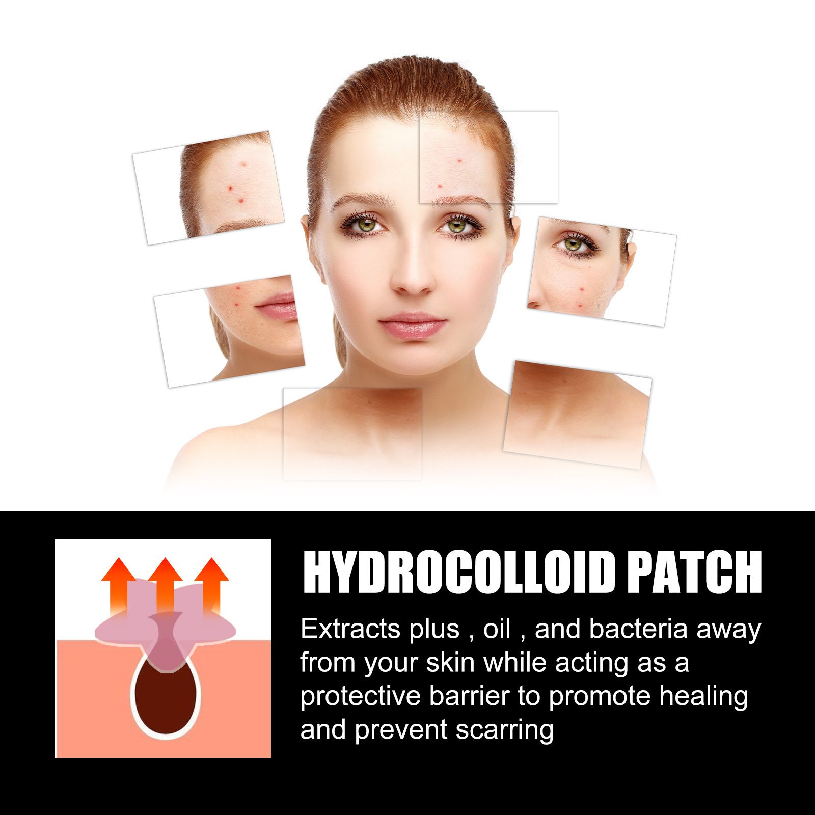 Free Get Gift 10pcs| SADOE 78pcs Acne Patch Acne Skin Care Product Acne Remover Acne Skin Care Acne Treatment Acne Removal Acne Control Cleanser Acne Cleanser Repair Acne Facial Skin Care Remove Acne