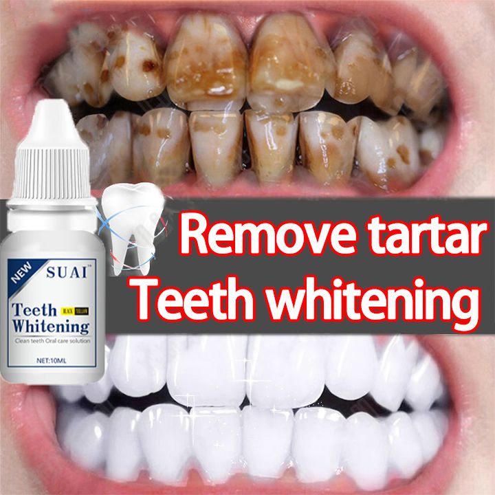 Quick and easy👍10ml Teeth Whitening Teeth Cleaning Mousse Mouthwash Toothpaste Remove Tartar Oral Health Stain Removal Freshen Breath Remove Plaque Stains Oral Odor Bright and tartar remover