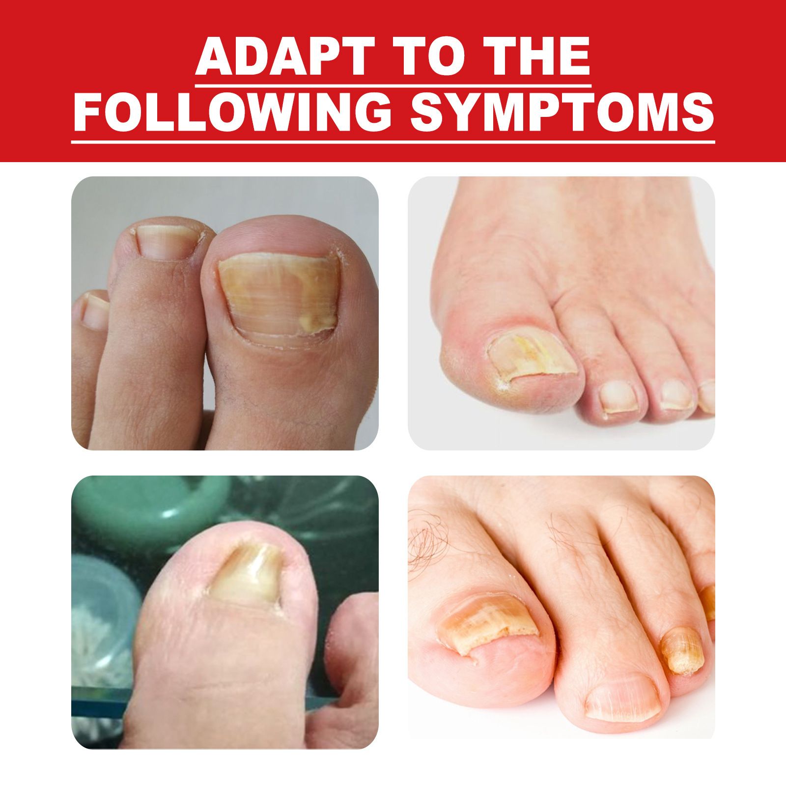 Onychomycosis Antibacterial，Ingrown Toenail Drops，solution Eliminate nail diseases on hands and feet painlessly for Thickening,Deformation，Brittle, Discoloured,Broken Nails