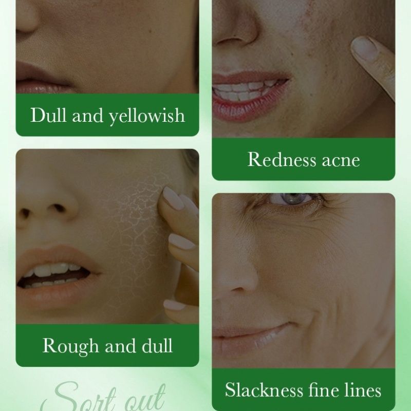 5pcs aloe vera face mask -sadoer skin care set natural plants - moisturize hydrating brightening whitening acne treatment | firming anti-wrinkle deeply nourish smooth anti-dark repair skin