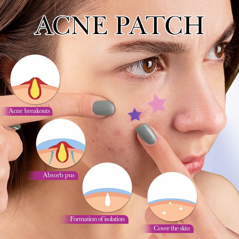 Free Get Gift 10pcs| SADOE 78pcs Acne Patch Acne Skin Care Product Acne Remover Acne Skin Care Acne Treatment Acne Removal Acne Control Cleanser Acne Cleanser Repair Acne Facial Skin Care Remove Acne
