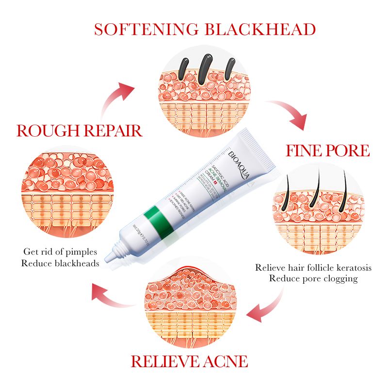 BIOAOUA Skin Care Set Salicylic Acid Acne Removal Cream Treats Pimples Remove Acne Dark Spots Shrinks Pores Oil-Free Budget-Friendly Fade Acne Marks Get Rid Acne Shrink Pores Soothes Redness