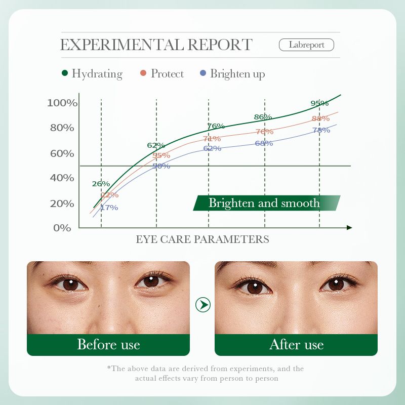 ZOZU Olive Oil  Nourishing Repairing Eye Cream Skin Care Dark Circles Wrinkles Natural Anti-Wrinkle Anti-Aging Moisturizing Firming Puffy Eye Treatment Under Brightening Beauty Reduces Wrinkles Smooth