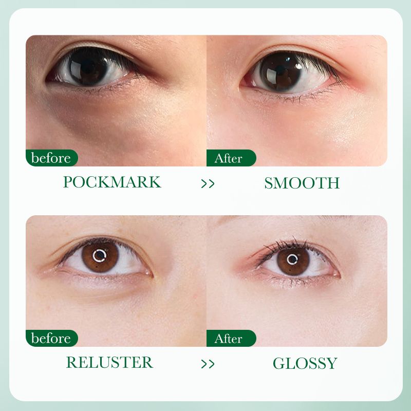 ZOZU Olive Oil  Nourishing Repairing Eye Cream Skin Care Dark Circles Wrinkles Natural Anti-Wrinkle Anti-Aging Moisturizing Firming Puffy Eye Treatment Under Brightening Beauty Reduces Wrinkles Smooth