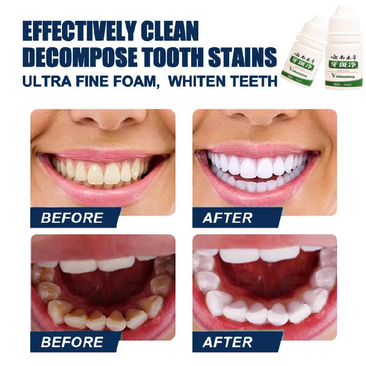 Teeth Whitening Teeth Cleaning Mousse Mouthwash Toothpaste Remove Tartar Oral Health Stain Removal Freshen Breath Remove Plaque Stains Oral Odor Bright and tartar remover