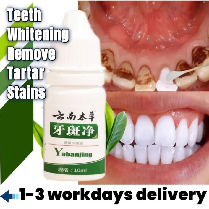 Teeth Whitening Teeth Cleaning Mousse Mouthwash Toothpaste Remove Tartar Oral Health Stain Removal Freshen Breath Remove Plaque Stains Oral Odor Bright and tartar remover