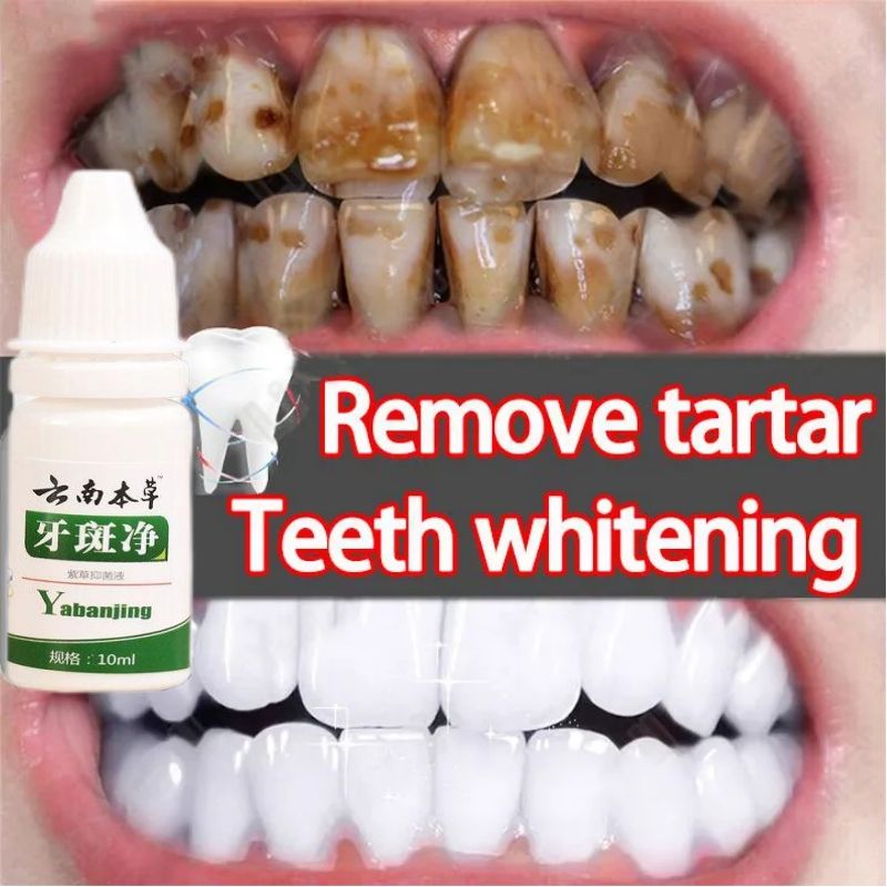 Quick and easy👍10ml Teeth Whitening Teeth Cleaning Mousse Mouthwash Toothpaste Remove Tartar Oral Health Stain Removal Freshen Breath Remove Plaque Stains Oral Odor Bright and tartar remover