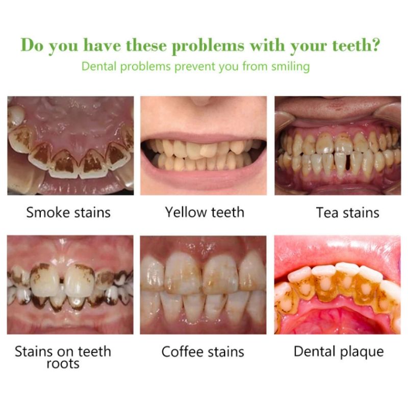 Quick and easy👍10ml Teeth Whitening Teeth Cleaning Mousse Mouthwash Toothpaste Remove Tartar Oral Health Stain Removal Freshen Breath Remove Plaque Stains Oral Odor Bright and tartar remover