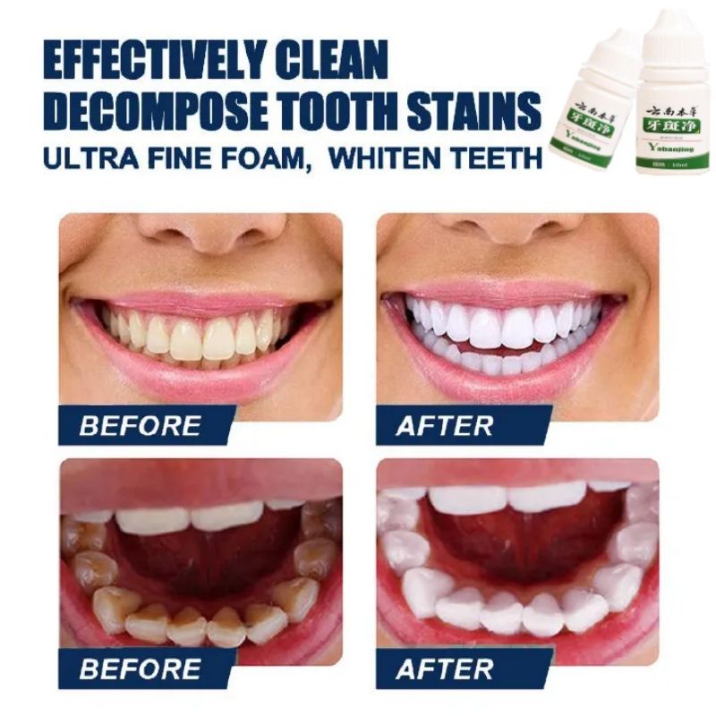 Quick and easy👍10ml Teeth Whitening Teeth Cleaning Mousse Mouthwash Toothpaste Remove Tartar Oral Health Stain Removal Freshen Breath Remove Plaque Stains Oral Odor Bright and tartar remover