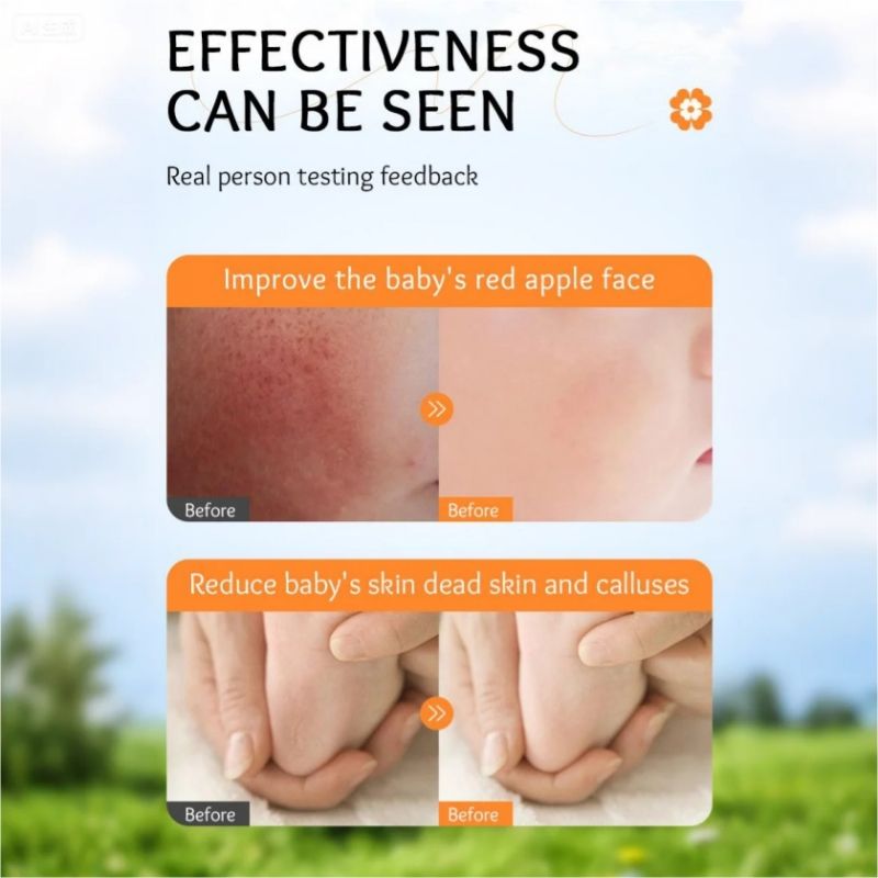 Calendula Baby Cream Sadoer Skin Care Set Sooth Tender Skin Child Skincare Child Cream Face Cream Vitamin E Moisturise Anti-crack Body Cream Prevent Redness Cracking Sooth Care Delicate Soft Smooth