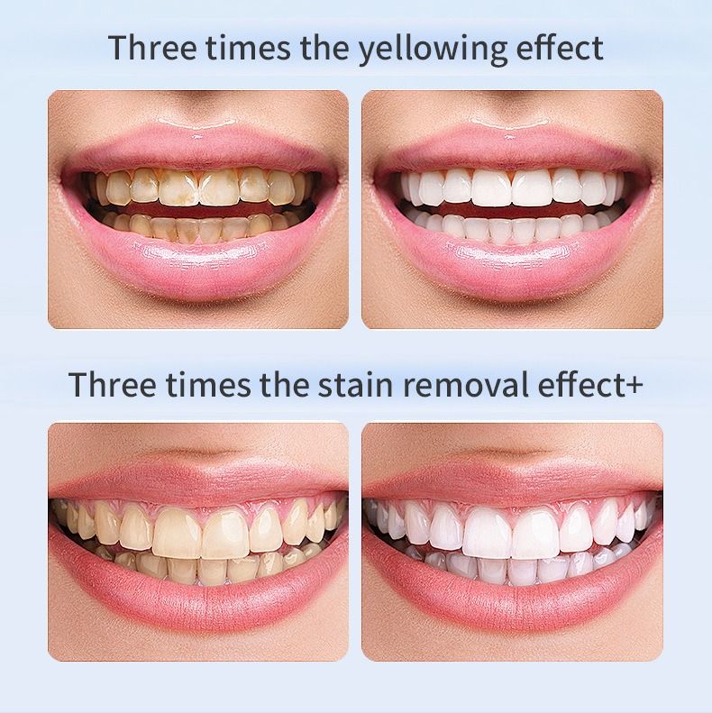 Automatic tooth cleaner cross-border African popular fashion adult automatic tooth cleaning instrument blue light ultrasonic electric toothbrush waterproof U-shaped cold light tooth beauty instrument