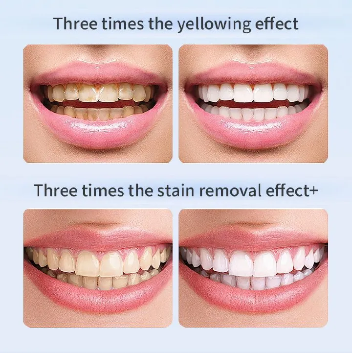 Automatic tooth cleaner cross-border African popular fashion adult automatic tooth cleaning instrument blue light ultrasonic electric toothbrush waterproof U-shaped cold light tooth beauty instrument
