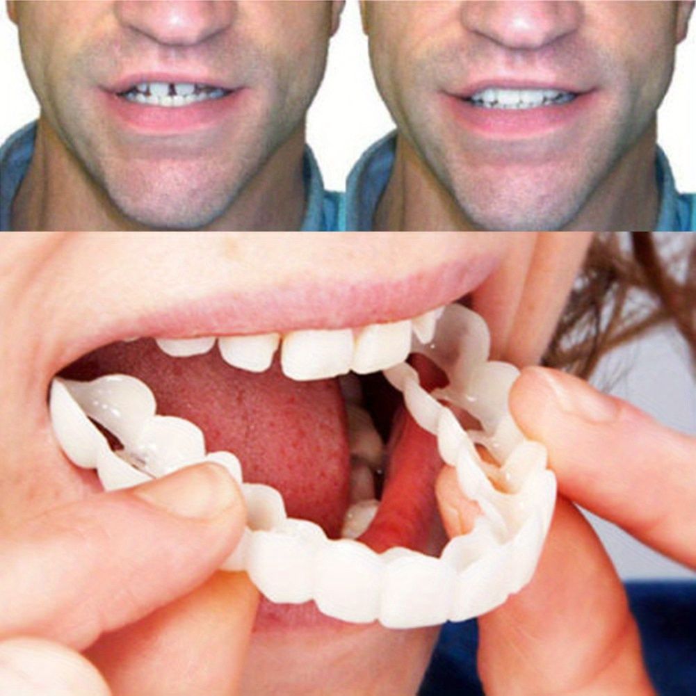 1 x Comfort Fit Flex White Denture Top Veneer - Enhance Your Smile with Ultra-Comfortable, Durable Plastic Material - Perfect Dental Accessory for Men and Women