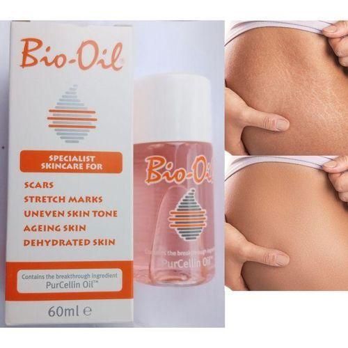 Beauty 5 In 1 Magical Stretch Marks Removal Oil Secret Ingredient