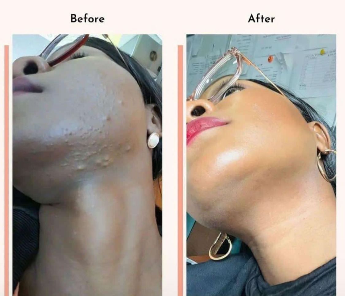 BEAUTIFUL YOLANDA ( Caramel Glow Face Body Cream, Whitening Face Cream, Whitening Serum, Knuckle Remover, Whitening Serum Stretchmark Vanishing Cream ) Select Option